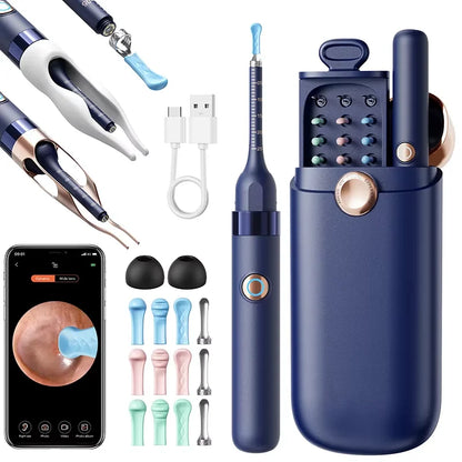 Smart Visual Ear Wax Removal System with 800W HD Endoscope and Storage Solution