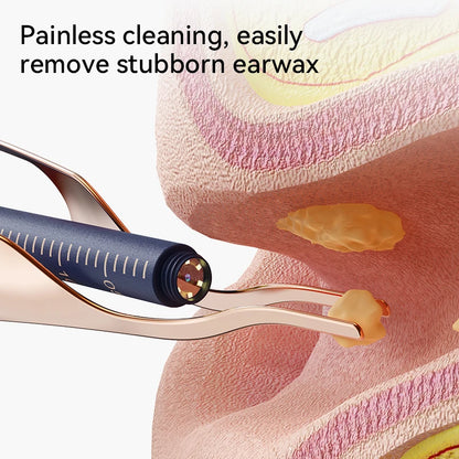 Smart Visual Ear Wax Removal System with 800W HD Endoscope and Storage Solution