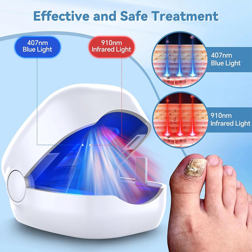 Nail Fungus Treatment LED Laser Device for Onychomycosis 905nm Infrared and 470nm Blue Light for Professional Nail Care