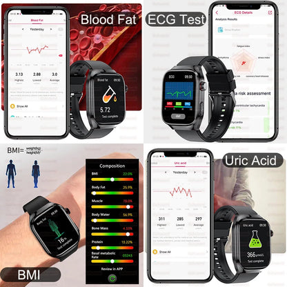 Smart Watch 2025 with Micro Physical Examination ECG, Uric Acid and Body Fat Monitoring, Bluetooth Calling