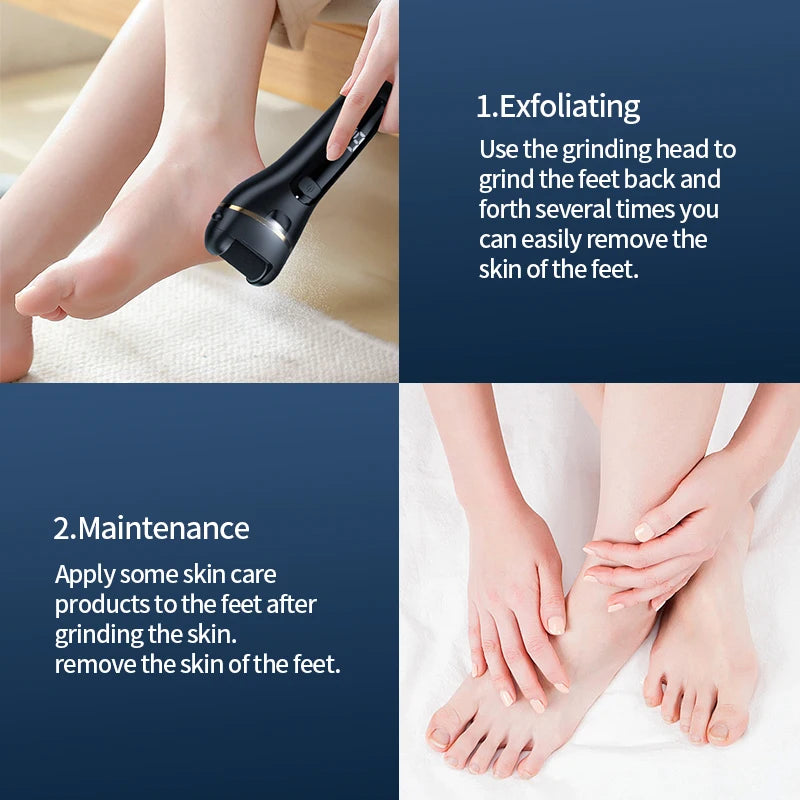  Electric Foot Grinder - USB-Powered Callus Remover with Adjustable Speed Settings 