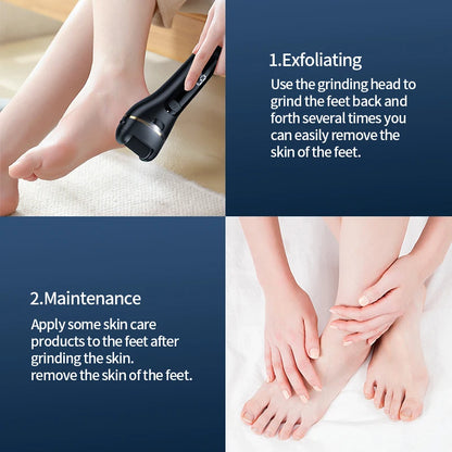  Electric Foot Grinder - USB-Powered Callus Remover with Adjustable Speed Settings 