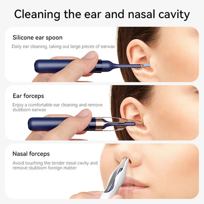 Smart Visual Ear Wax Removal System with 800W HD Endoscope and Storage Solution