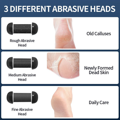  Electric Foot Grinder - USB-Powered Callus Remover with Adjustable Speed Settings 